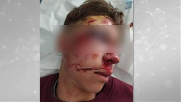 Brutal agresión a un menor en plena calle en Parla