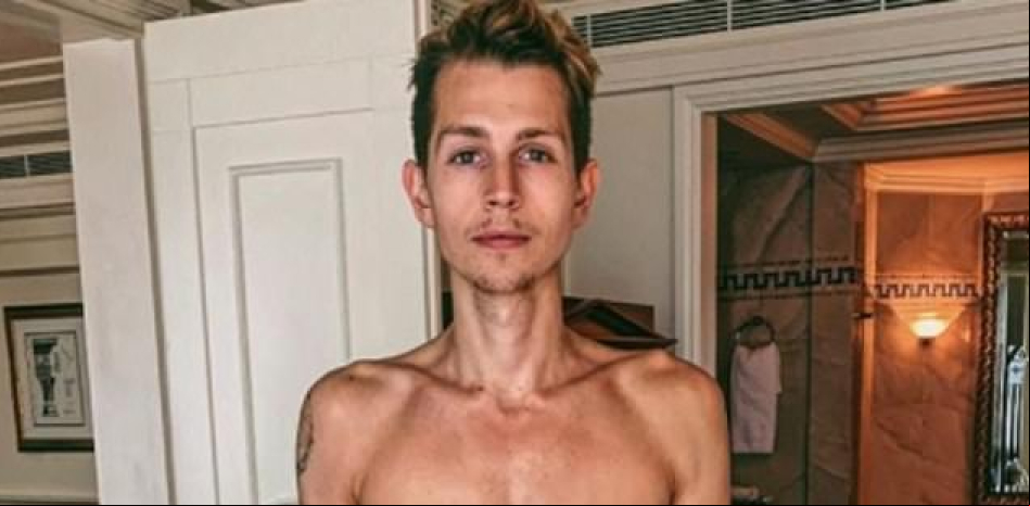James McVey, cantante de The Vamps, revela su lucha contra la anorexia
