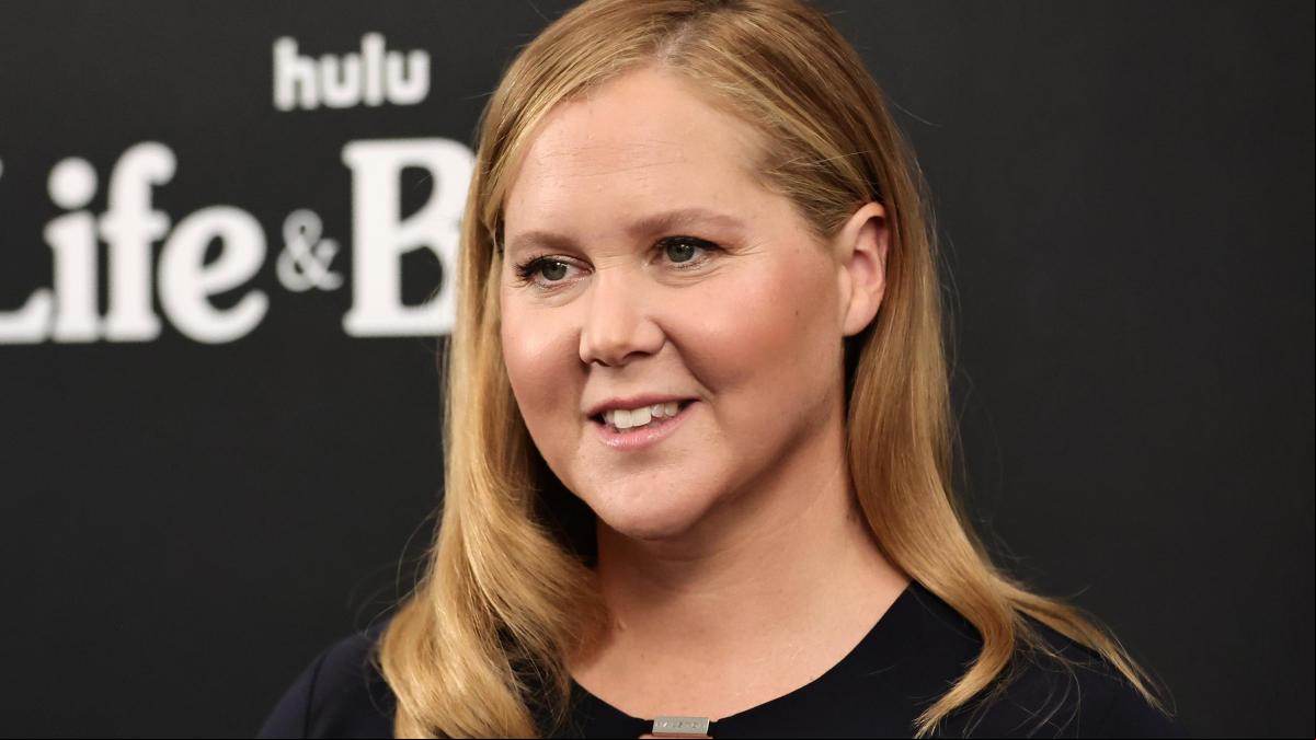 ¿Qué es el síndrome de Cushing, el extraño trastorno que sufre Amy Schumer?