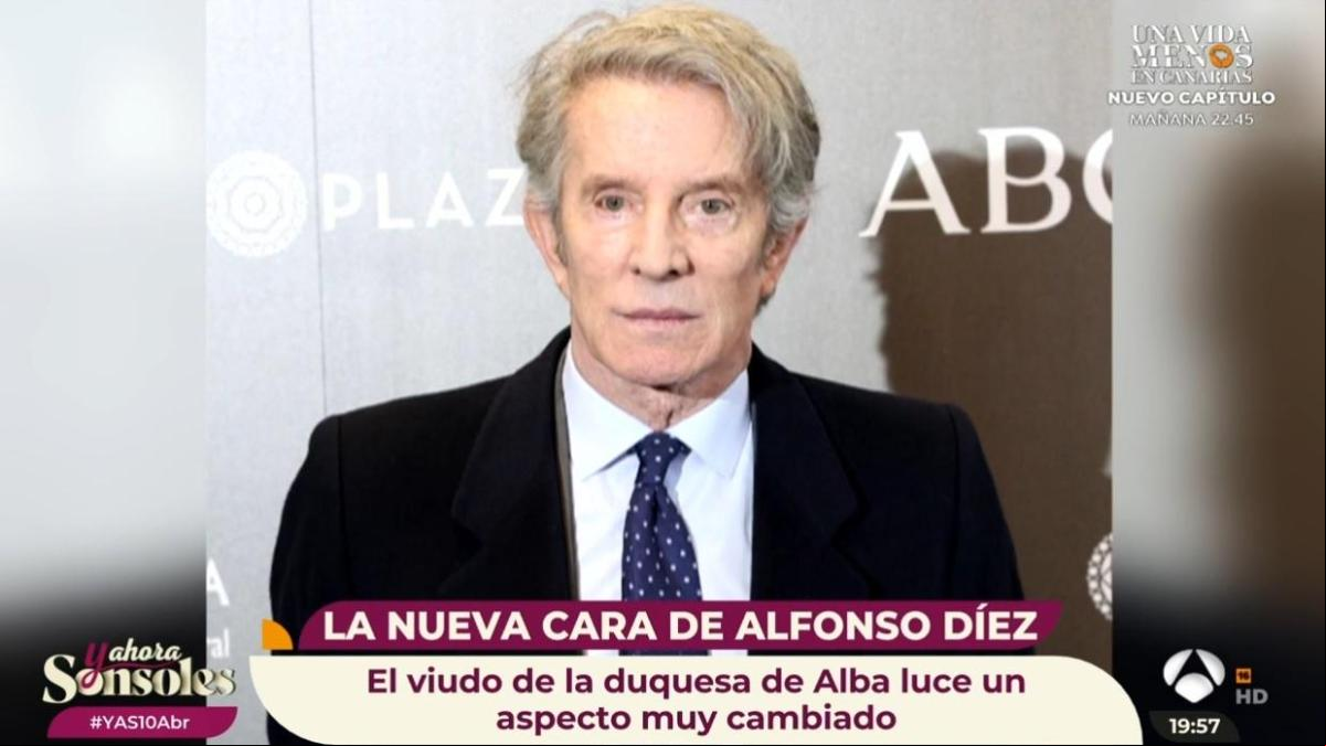 El viudo de la duquesa de Alba impacta con su rejuvenecido rostro: Tu cara no me suena, Alfonso