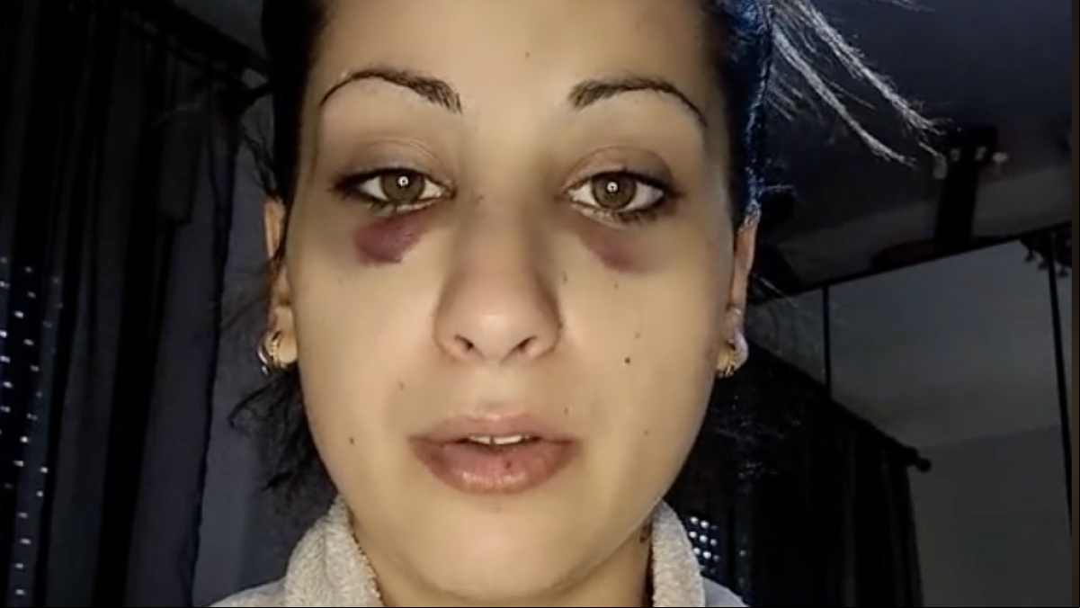 El duro testimonio de una joven tras recibir una paliza por parte de una familia en plena calle de Lleida: ”Veníamos de celebrar nuestro aniversario”