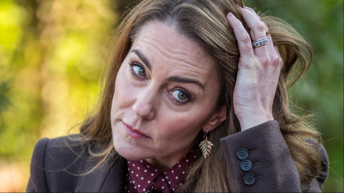 El pasado médico de Kate Middleton: el origen y significado de su cicatriz en la cabeza