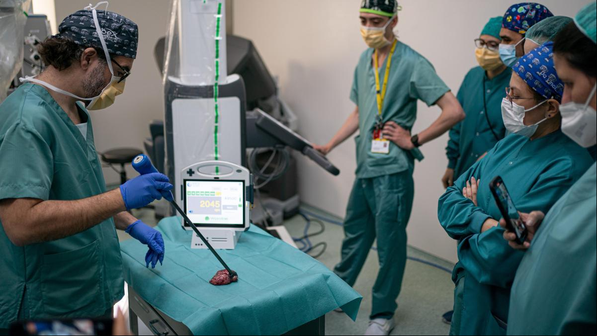 Los especialistas ven al SNS preparado para implantar ya el cribado del cáncer de pulmón
