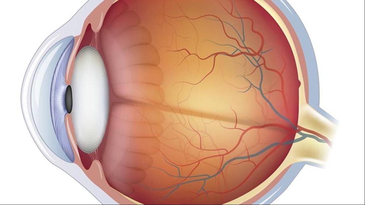 Aniridia, síntomas, causas y el tratamiento para esta condición ocular