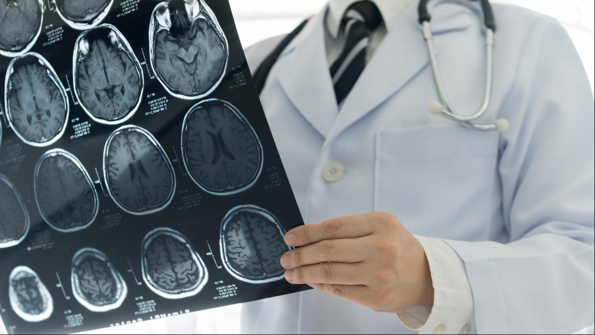 Ni correr ni levantar pesas: estos son los deportes (poco practicados) que recomienda un prestigioso oncólogo español para prevenir el cáncer