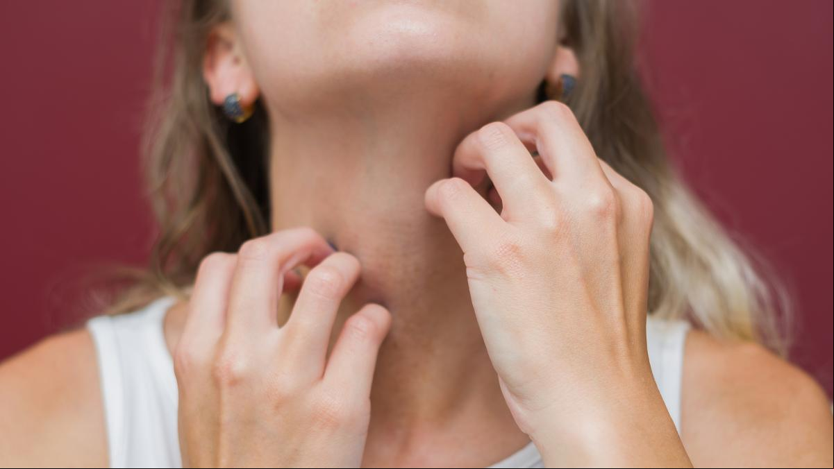 Tratamientos para aliviar el picor por dermatitis atópica