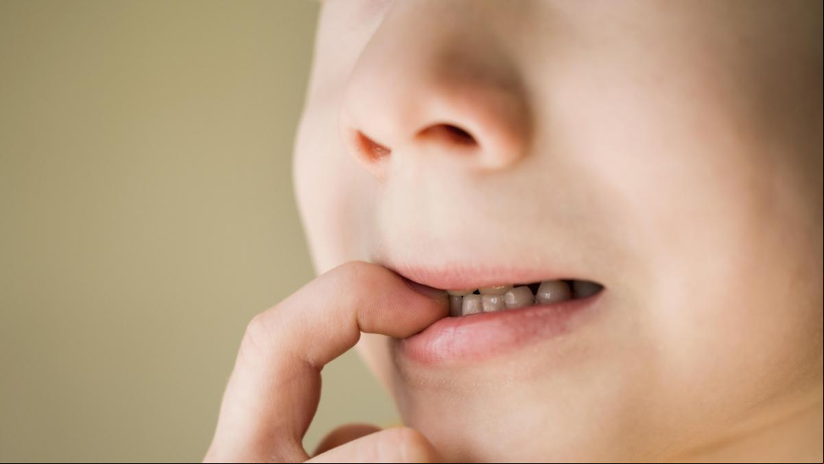 ¿Tu hijo se muerde las uñas? Así afecta a su salud dental este hábito