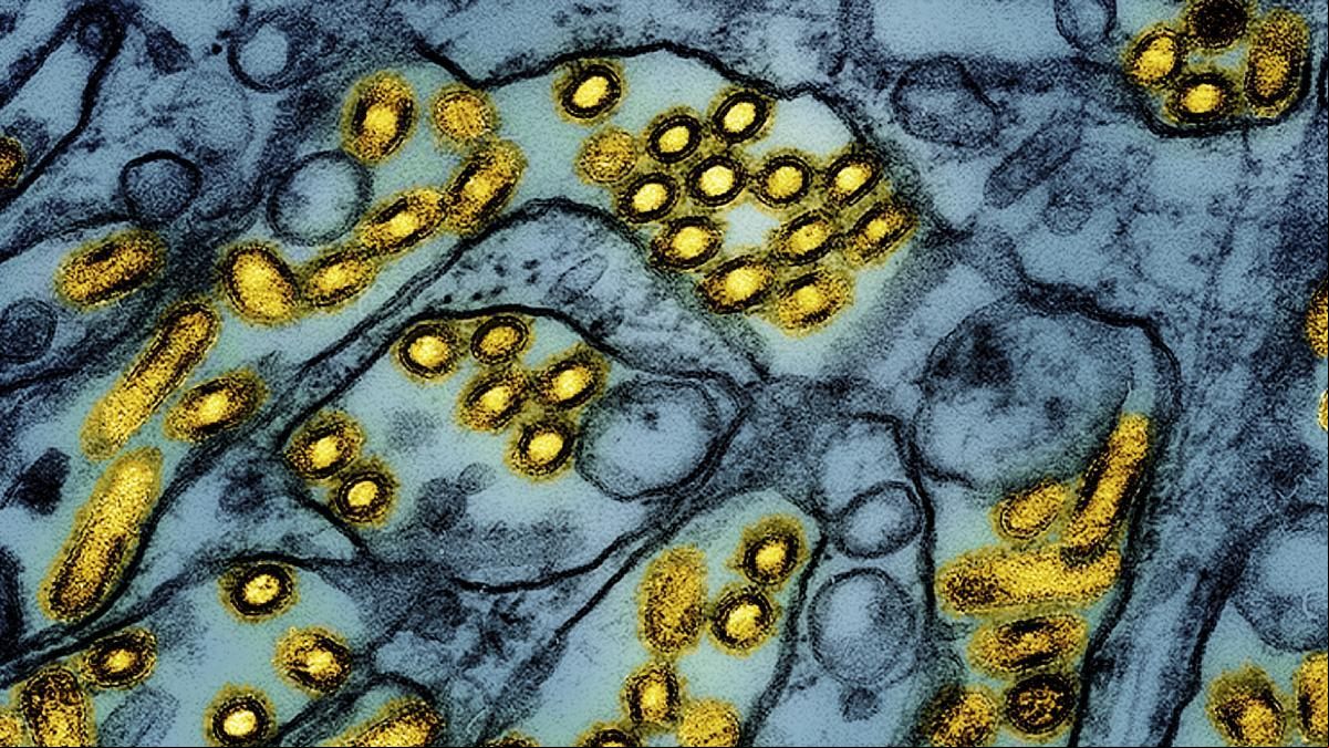 California declara el estado de emergencia por la gripe aviar tras un caso grave en Luisiana