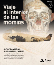 Viaje Al Interior De Las Momias