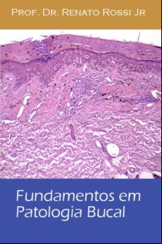 Fundamentos Em Patologia Bucal (ebook)
