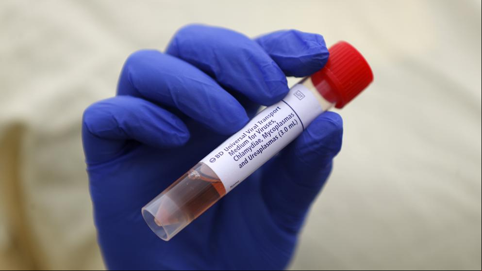 Antoni Trilla: “En Catalunya no se pueden hacer pruebas de coronavirus a todos”